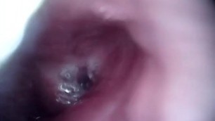 The Heartbeat in my Esophagus 3